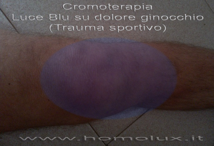 cromoterapia luce blu per dolore ginocchio trauma sportivo